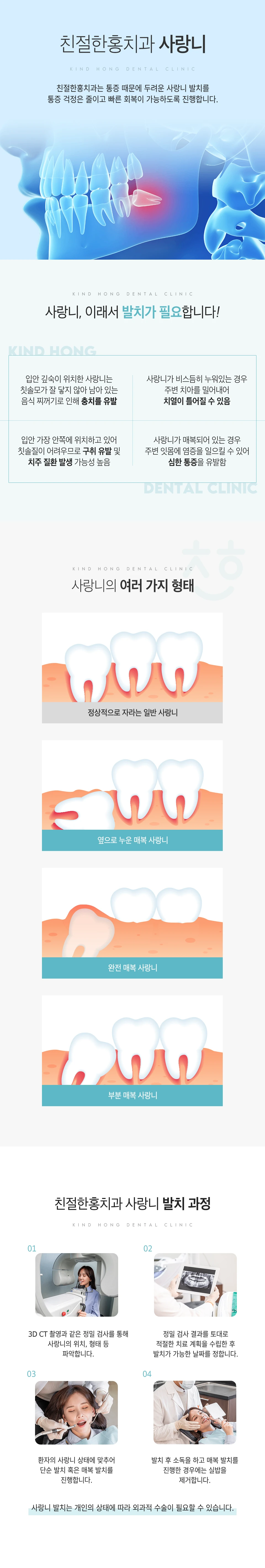 친절한홍치과 사랑니